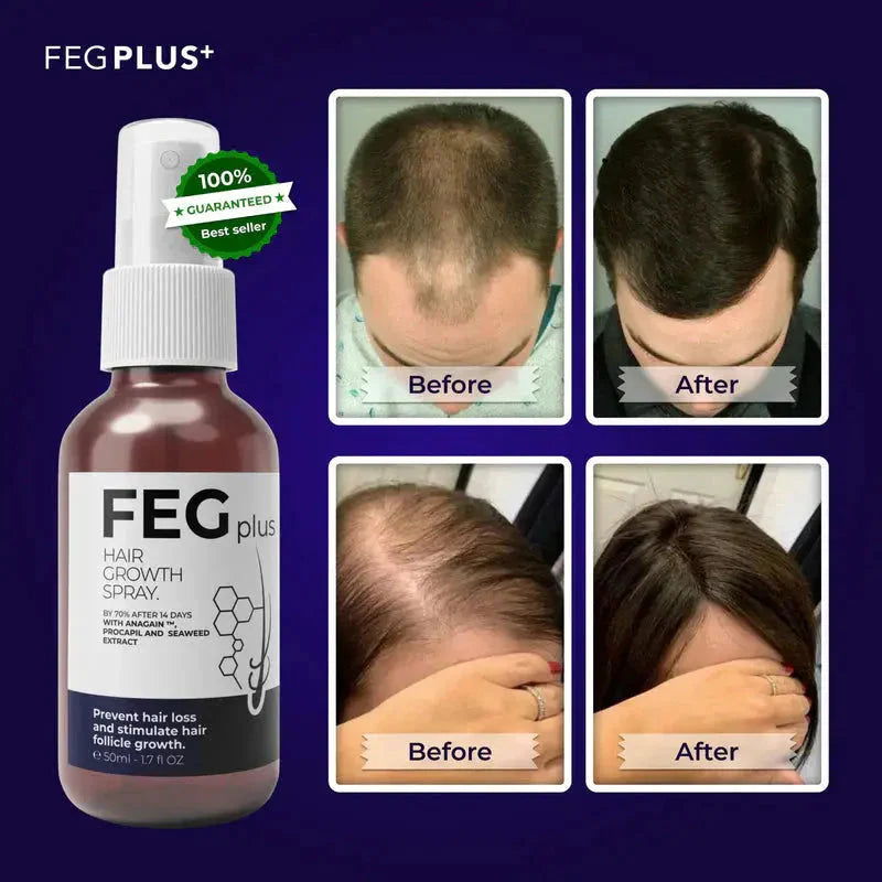 FEG Plus Hair Growth Spray | Strong Hair Regrowth Formula 50ml