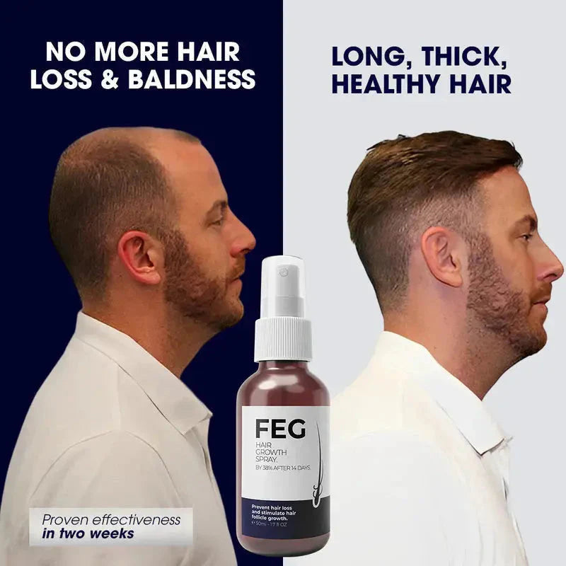 FEG Plus Hair Growth Spray | Strong Hair Regrowth Formula 50ml